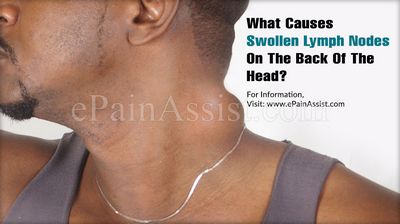 A Look at the Symptoms of Swollen Glandular Glands Swelling in your