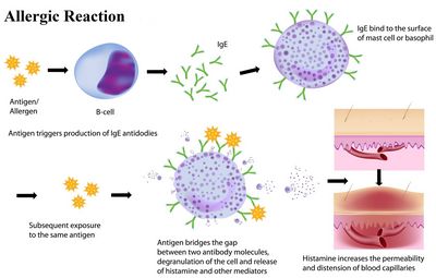 Allergic Responses Explained also different