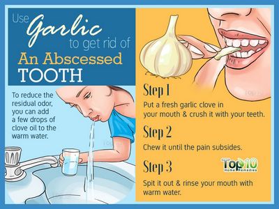 How To Treat Tooth Abscesses? by the presence of pus