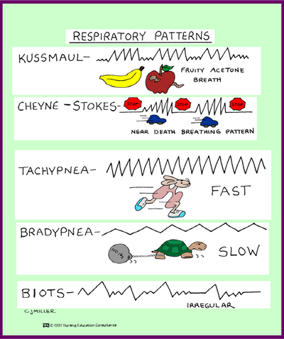 Kussmaul Respirations you are