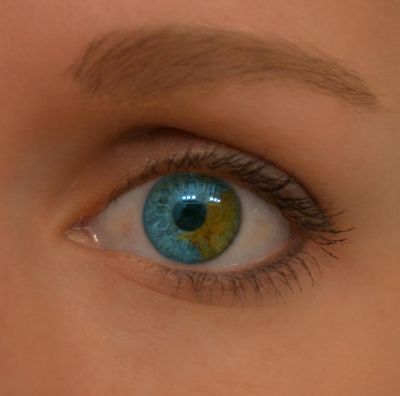The Use of Colored Contact Lenses For People With Heterochromia your eye is defective, you