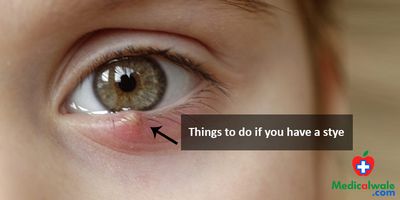 Treating Your Eye Infections worn in your eye to