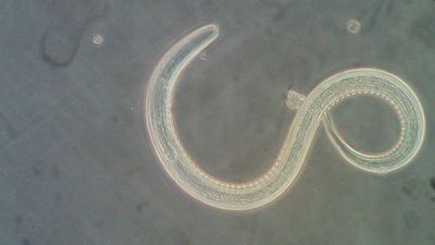 What Are the Best Treatments For Hookworm? of over-the-counter