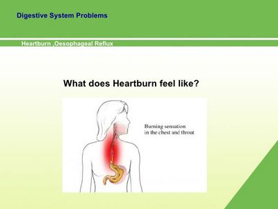 What Does Heartburn Feel Like? one of those millions of